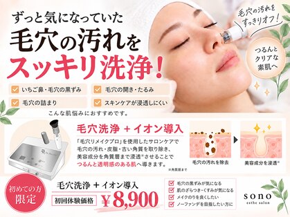 ソーノ(sono)の写真