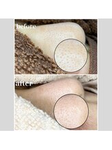 毛穴専科/毛穴洗浄＋白玉waxで黒ずみ除去