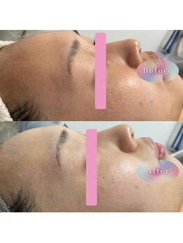 ルルーディア(LOULOUDIA)/くすみクリアにトーンアップ♪