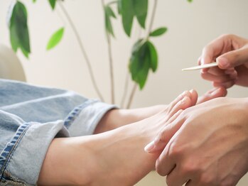 北区天神橋巻き爪センター/《巻き爪矯正》