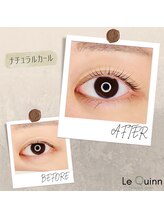 ルクイン 恵比寿 白金(Le Quinn)/Before&After《ナチュラル》