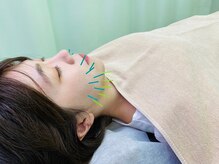 ふれあい整骨院/お顔の悩みに美容鍼