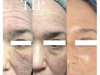 22クラレ(22curare)/エイジングケア、おシワケアに◎