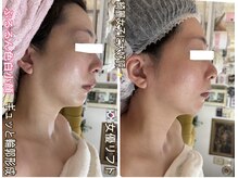 アルページュ(Arpege)