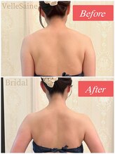 ヴェルセーヌ(VelleSaine)/首肩ラインを美しく☆