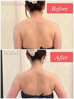 ヴェルセーヌ(VelleSaine)/首肩ラインを美しく☆