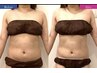 【上半身集中ダイエット】最新痩身マシン×筋膜ボディコルギ120分