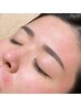 【凸凹肌改善】ニキビ即日効果/圧倒的効果実感!エステ版ダー◎ペン