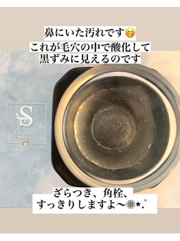 スムース(Smoooth)/毛穴洗浄でとれた汚れ
