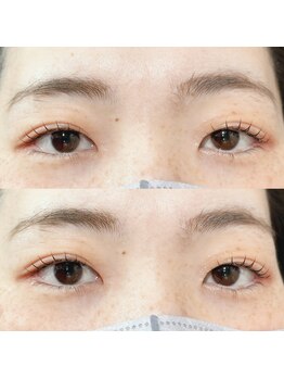 アイコンホイップ(ICON whip)/