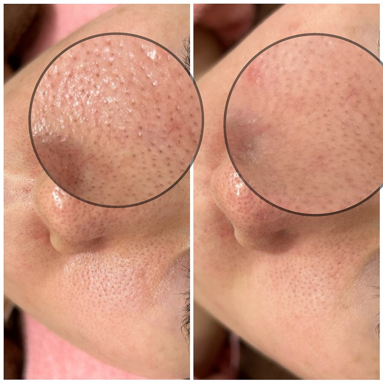 クラティス(CRATIS)｜ホットペッパービューティー