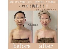 シャルム(Charme.)/骨格矯正+頭蓋骨矯正(症例写真)