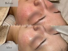 シェリーミル(Cherie Miru)/美白/赤み/色むら改善