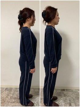 アニュームーン 草津エイスクエア店(aNewMoon)/骨格姿勢矯正/ビフォーアフター