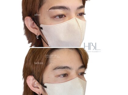 アブソーブの写真