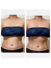 紫檀(シタン)/1度の施術で体感！美ボディケア