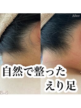 エリス(ELISSE)/自然で整ったえり足