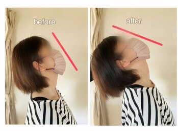芦田整体療術院/固まってた首の可動域が改善!