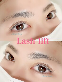 シュシュ(chouchou)/まつぱ