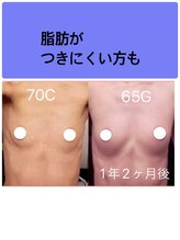 ビサンテ(Vi sante)/バスト変化