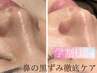 【学割U24学生限定】☆男女OK☆鼻の黒ずみ徹底ケア¥2,750