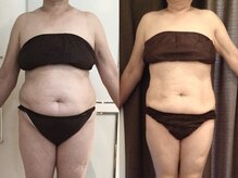 美容整体ウェリナ 名駅院/.【ダイエットbefore→after】