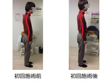 ストラボ 横浜店/ビフォーアフター１１