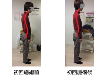 ストラボ 横浜店/ビフォーアフター１１