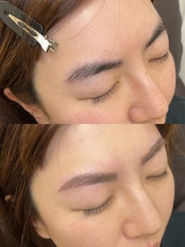 テソロ(Tesoro.)/顔脱毛＋アイブロウ