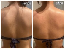 イーネ オランジェ 八王子店の雰囲気(首、肩凝り改善・頭痛改善の脳内ヒーリング)