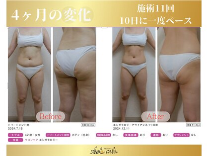 フィールカーム(feel calm)の写真