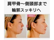アンジュ(Anju)の雰囲気（着実に深層から肌を整え見た目を変えていく熟練技&高品質を保証）