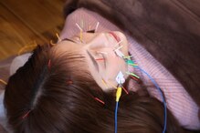 カナヤ鍼灸整骨院