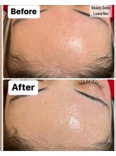 ルアナ ナオ(Luana Nao)/ワックス脱毛☆眉毛も整えます！