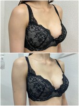 バーディー(BIRDIE)/施術１回/２０代