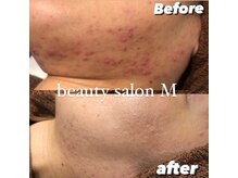 エム(M)/何年も悩み続けているあなたに