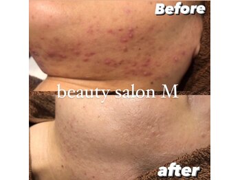 エム(M)/何年も悩み続けているあなたに