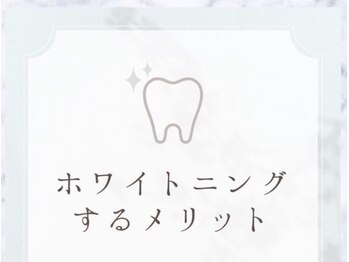 ホワイトニングサロン 豊中/ホワイトニングをするメリット★