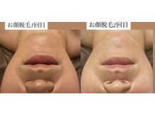 ディサイドロー(DECIDE L.A.W)/ご来店のタイミング！