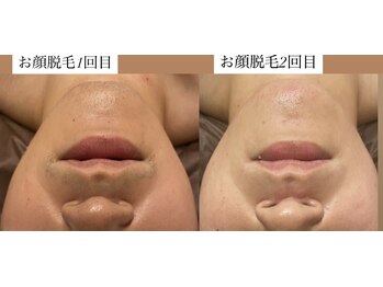 ディサイドロー(DECIDE L.A.W)/ご来店のタイミング！