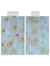 トランク(Trunk)/ハイドラ♪before→after