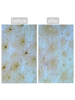 トランク(Trunk)/ハイドラ♪before→after