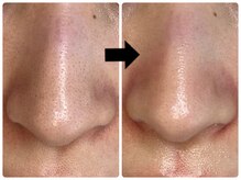 エフェクト 塚口店(effect)/before &nbsp;&nbsp;after