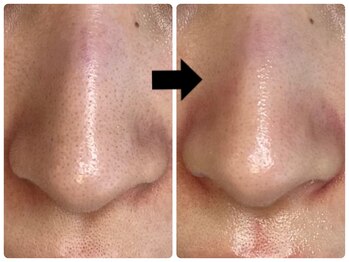 エフェクト 塚口店(effect)/before after