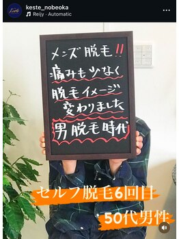 ケステ(Keste)/セルフ脱毛