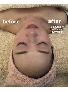 アスエ(ASUE)/当店人気のフェイシャルで美しく