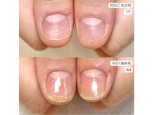 ジェル不使用の【ネイルケア育成】でナチュラル美爪へ♪