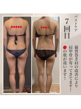 リリー(Lily)/ビフォーアフター