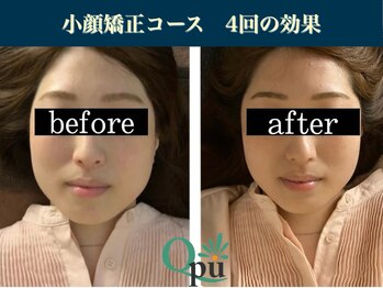 キュープ 表参道店(Qpu)/続けた方しか感じられない変化♪