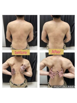 ファミリーセルフサロン 輪(Wa)/背面リンパ+よもぎ蒸しコース